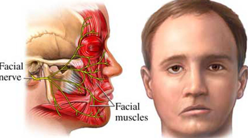 SOĞUK HAVALAR YAKLAŞIRKEN YÜZ FELCİNE DİKKAT!