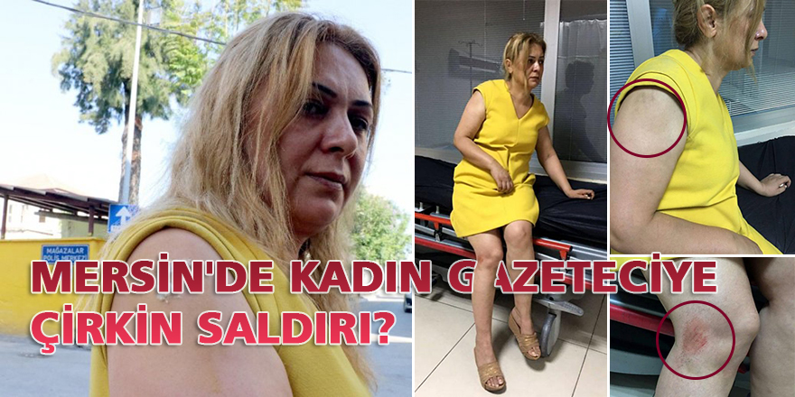 Kadın gazeteciye çirkin saldırı