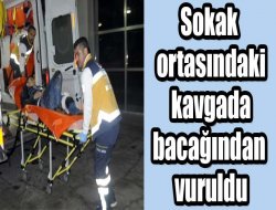 Sokak ortasındaki kavgada bacağından vuruldu