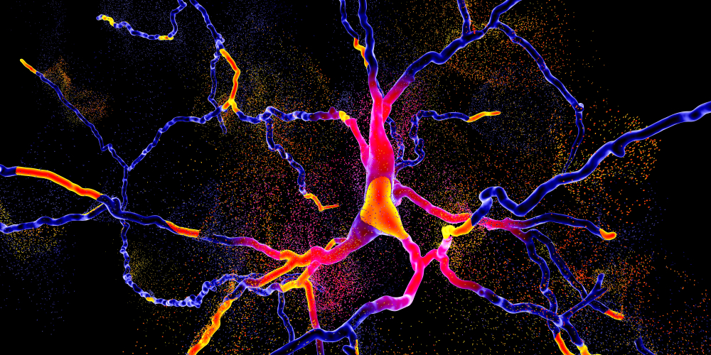 Eğer sizde Bu belirtiler  varsa dikkat!... Parkinson   olabilirsiniz