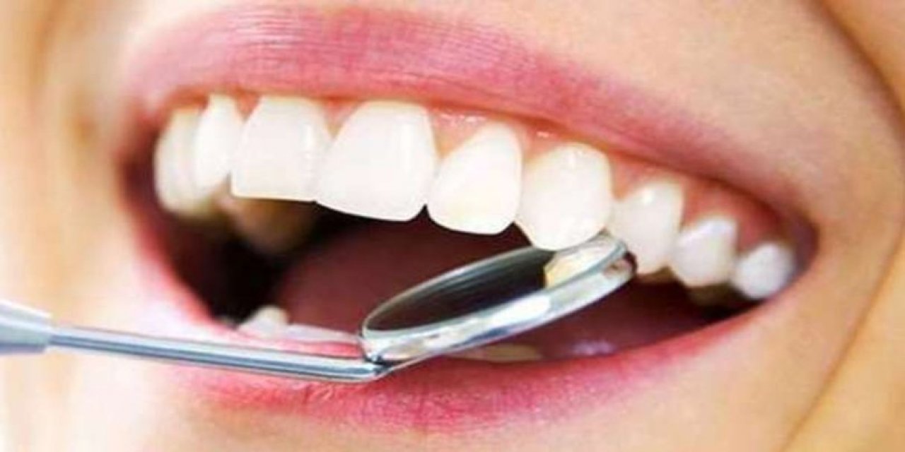 Diş Taşı Nedir? Neden Oluşur?