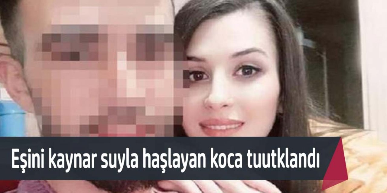 Eşinin kaynar suyla haşlayan koca tutuklandı