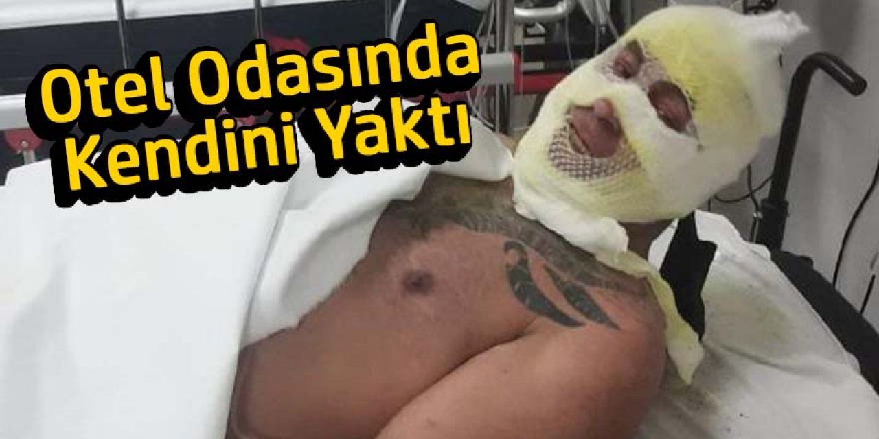 Otel odasında üzerine benzin döküp, kendisini yaktı