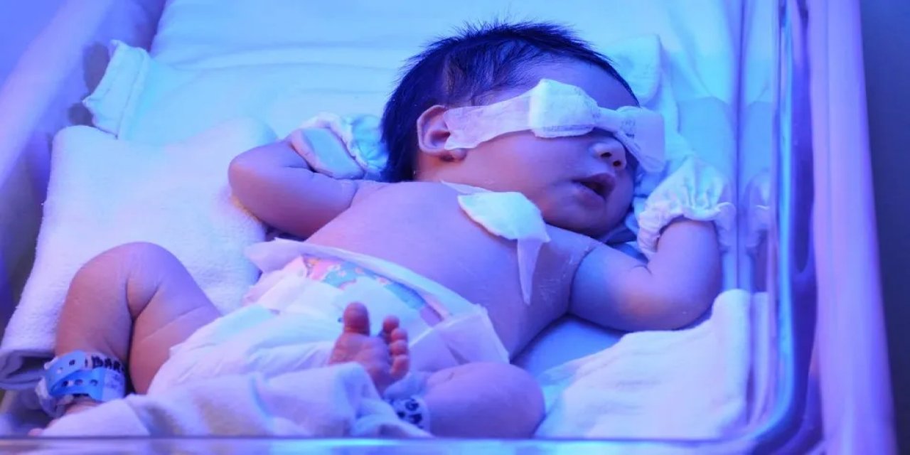 Çocuklarda Sarılığa Eşlik Eden Belirtilere Dikkat!