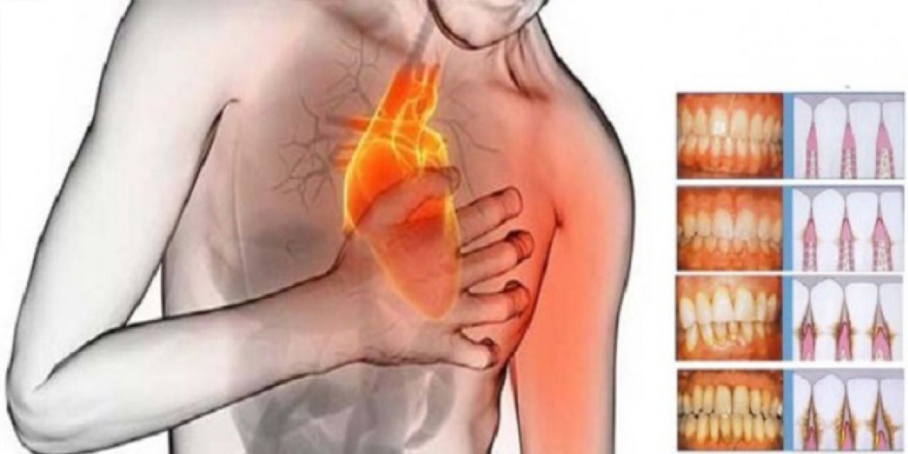 Ağız sağlığını korumak hayati sorunlara karşı alınabilecek önlemlerin başında geliyor