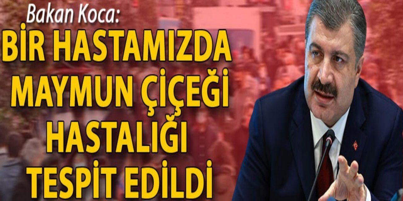 Bakan Koca: Bir hastamızda maymun çiçeği hastalığı tespit edildi