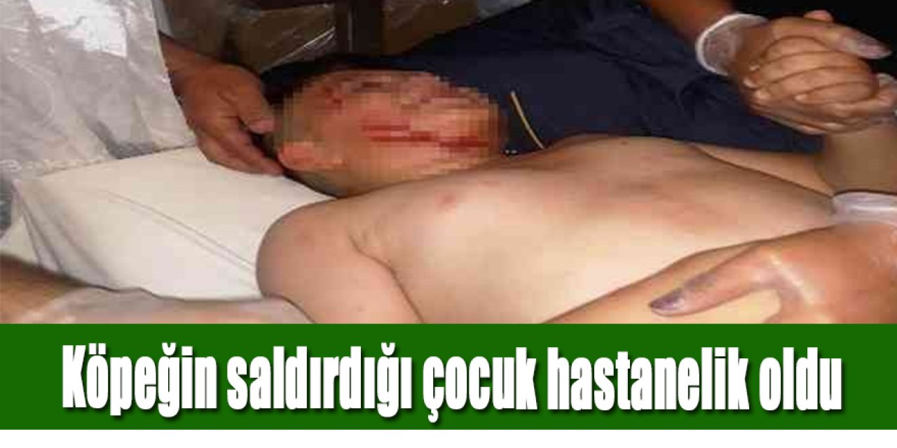 Köpeğin saldırdığı çocuk hastanelik oldu