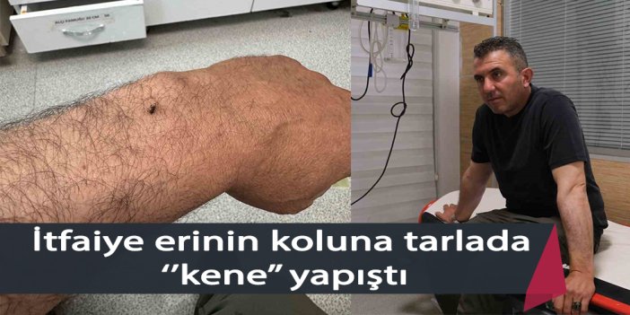 İtfaiye erinin koluna tarlada ‘’kene’’ yapıştı!